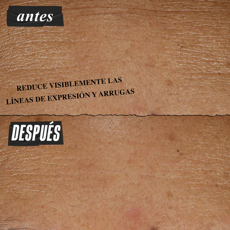 Micro-Dose Anti-Aging - Sérum Antiedad con Retinol Puro, ceramidas y péptido