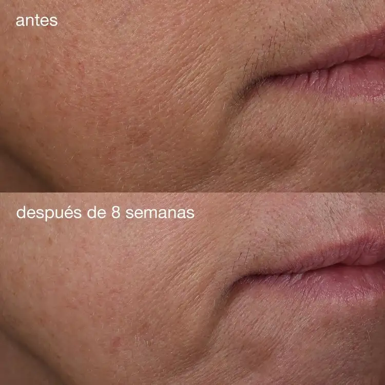 phyto nature - Serum reafirmante, reduce los signos del envejecimiento