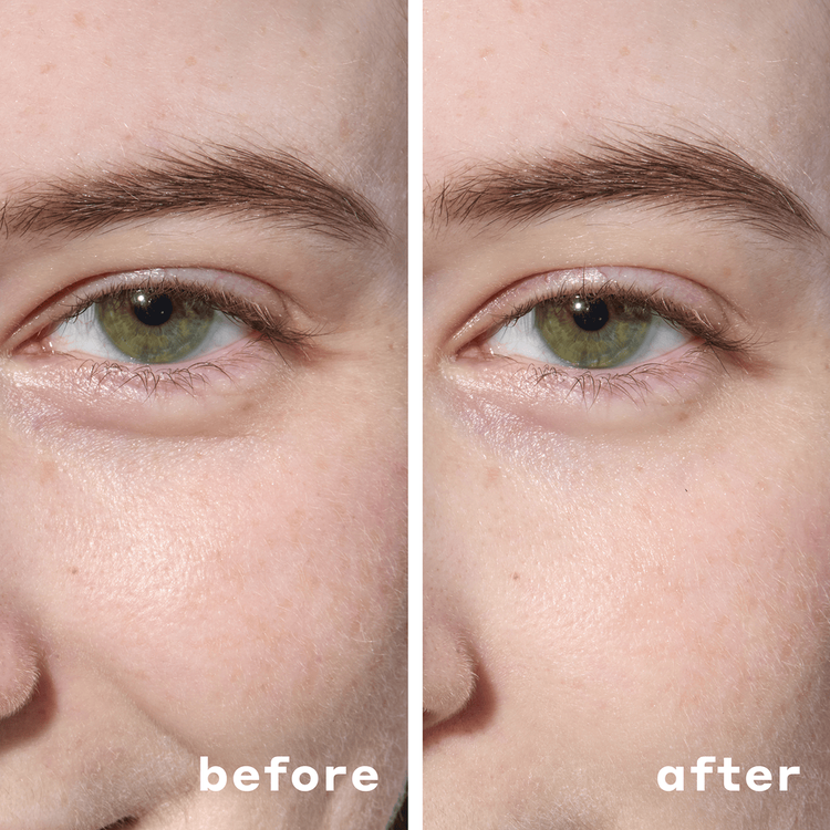 Hydrating Hydrogel Under Eye Masks - Mascarillas Hidratantes para Contorno de Ojos, con hidrogel