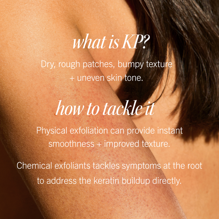 KP Bump Eraser - Exfoliante Corporal con AHA, anti-aspereza - 226 g