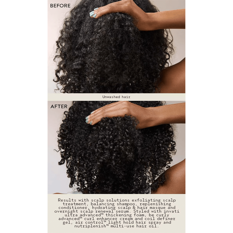 Scalp Advanced Tratamiento hidrata y cuida el cuero cabelludo