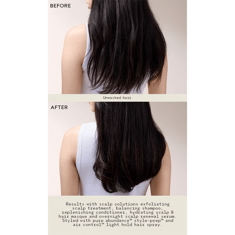 Scalp Advanced Tratamiento hidrata y cuida el cuero cabelludo