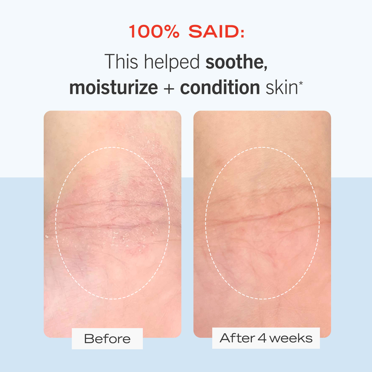 Ultra Repair Cream - Crema Corporal Intensiva, calmante y antioxidante - 170 g