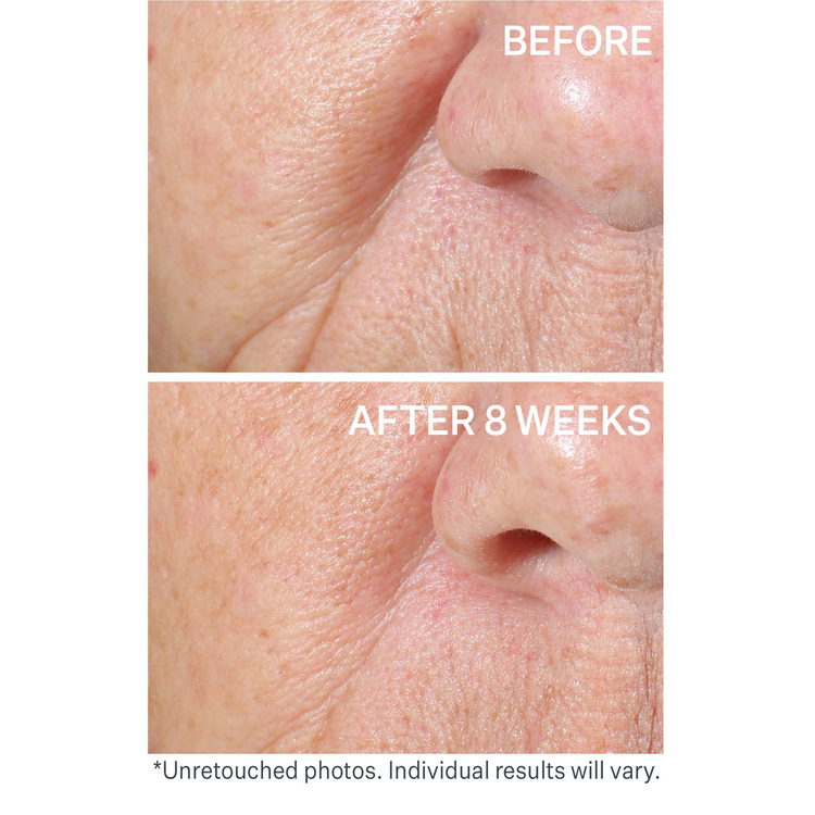 Peptight® - Sérum Reafirmante Facial, lifting visible en 1 semana - 30 ml