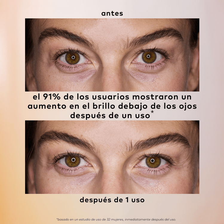 Brighten Up - Parche de Hidrogel para Contorno de Ojos, iluminador con vitamina C - Patch Set